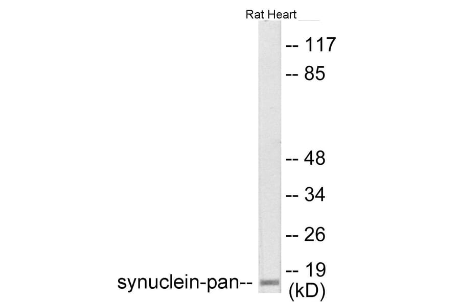 Western Blot - Synuclein-pan Cell Based ELISA Kit (CB6158) - Antibodies.com