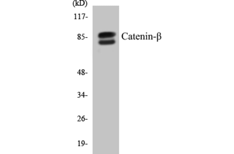 Western Blot - beta Catenin Cell Based ELISA Kit (CB5106) - Antibodies.com
