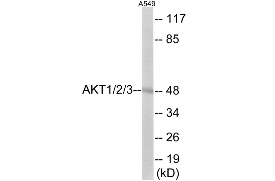 Western Blot - AKT1 + 2 + 3 Cell Based ELISA Kit (CB6149) - Antibodies.com