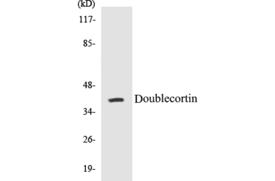 Western Blot - Doublecortin Cell Based ELISA Kit (CB5209) - Antibodies.com