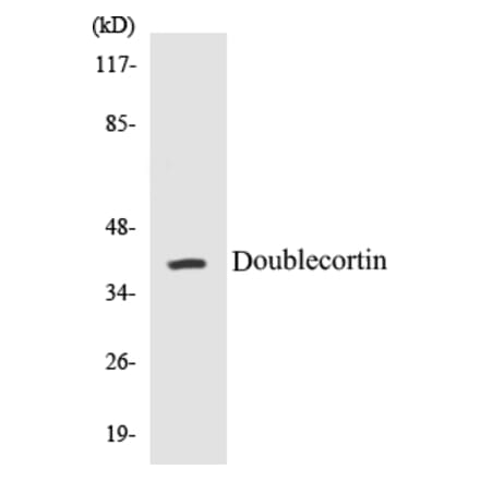 Western Blot - Doublecortin Cell Based ELISA Kit (CB5209) - Antibodies.com