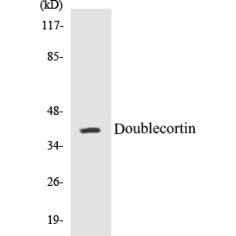 Western Blot - Doublecortin Cell Based ELISA Kit (CB5209) - Antibodies.com