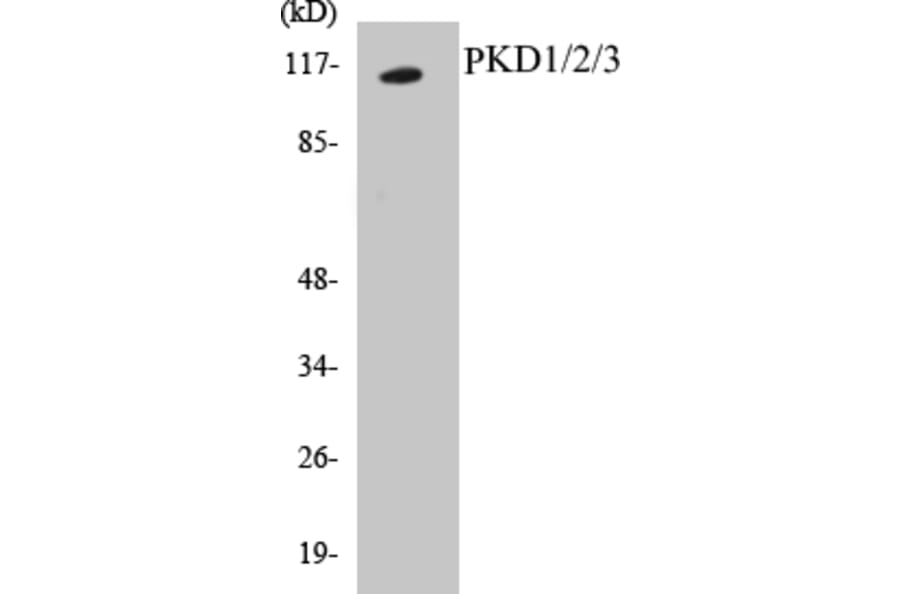 Western Blot - PKD1 + 2 + 3 Cell Based ELISA Kit (CB5569) - Antibodies.com