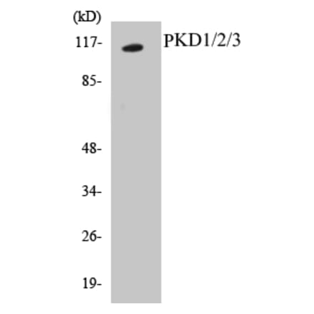 Western Blot - PKD1 + 2 + 3 Cell Based ELISA Kit (CB5569) - Antibodies.com