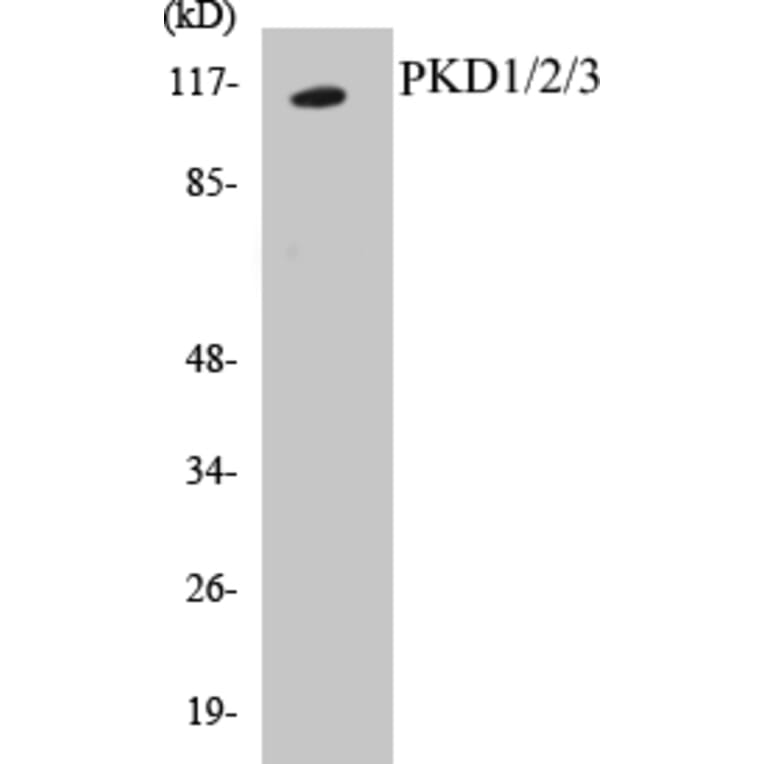 Western Blot - PKD1 + 2 + 3 Cell Based ELISA Kit (CB5569) - Antibodies.com