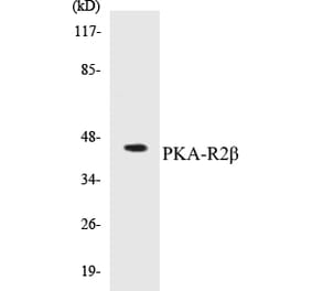 Western Blot - PKA-R2 beta Cell Based ELISA Kit (CB5560) - Antibodies.com