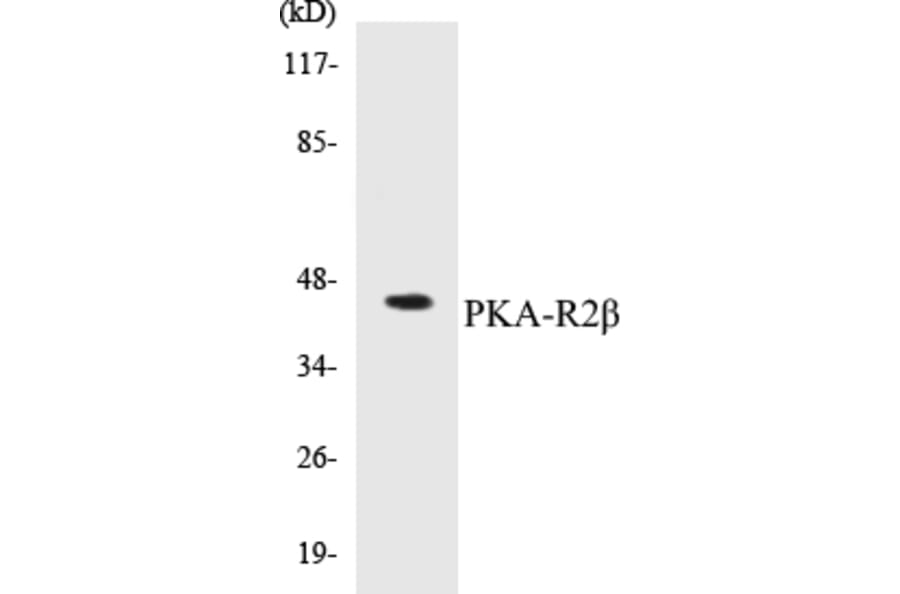 Western Blot - PKA-R2 beta Cell Based ELISA Kit (CB5560) - Antibodies.com