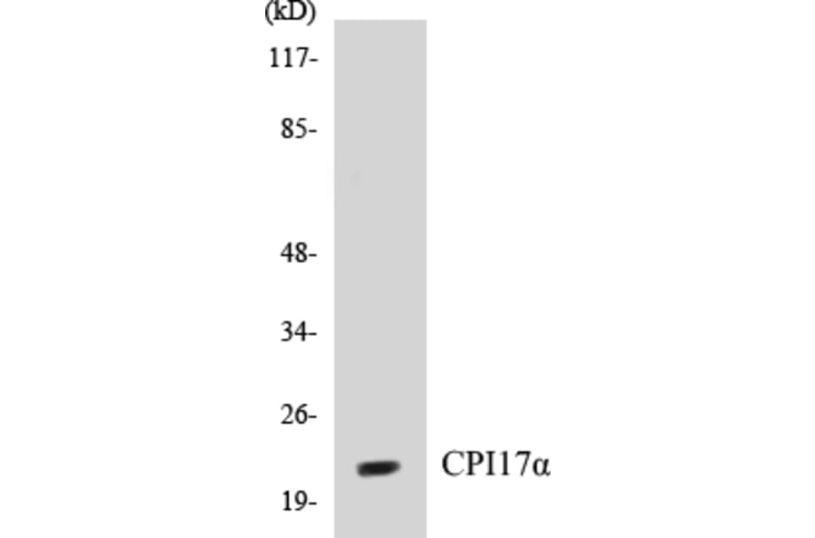 Western Blot - CPI17 alpha Cell Based ELISA Kit (CB5166) - Antibodies.com