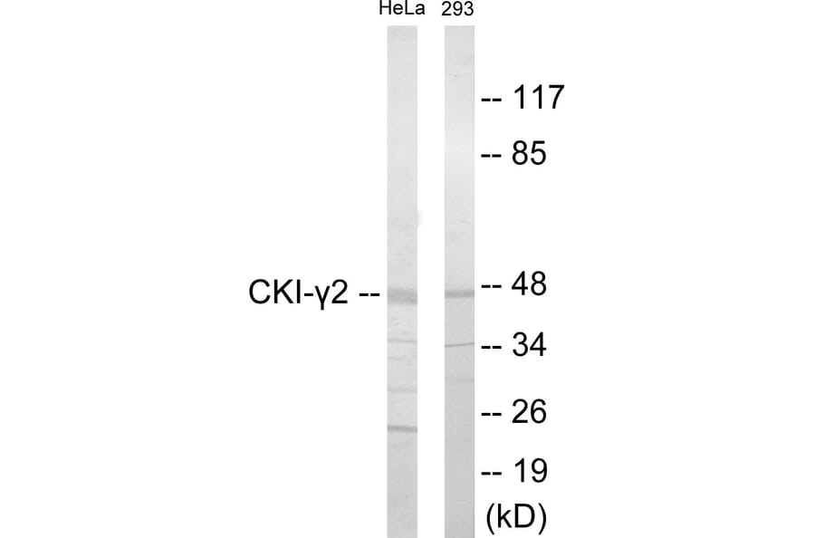 Western Blot - CKI gamma 2 Cell Based ELISA Kit (CB5938) - Antibodies.com