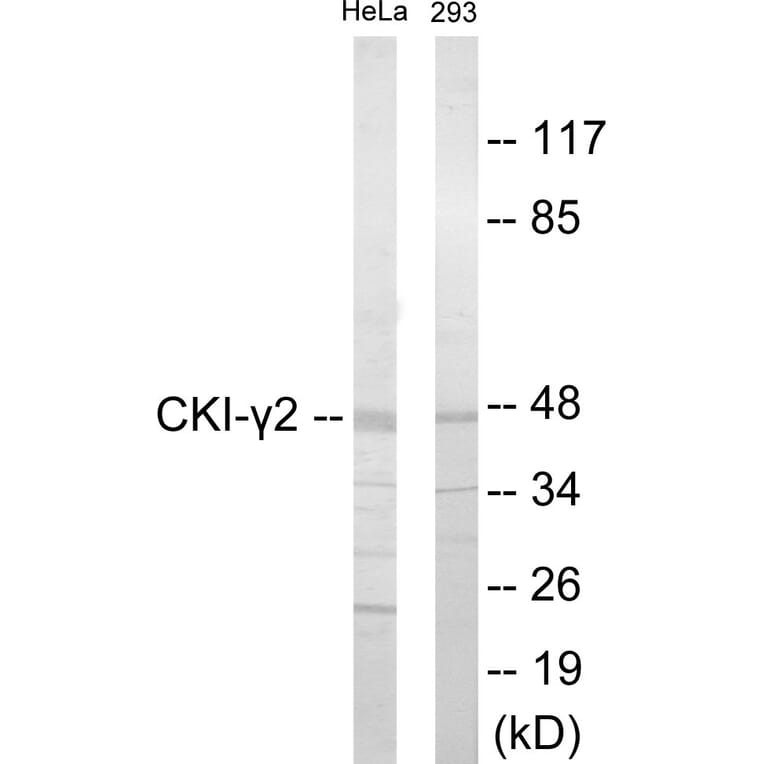 Western Blot - CKI gamma 2 Cell Based ELISA Kit (CB5938) - Antibodies.com