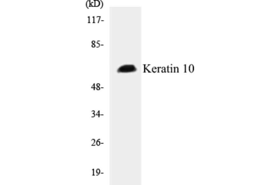 Western Blot - Keratin 10 Cell Based ELISA Kit (CB5392) - Antibodies.com