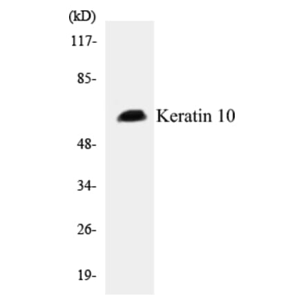 Western Blot - Keratin 10 Cell Based ELISA Kit (CB5392) - Antibodies.com