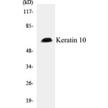 Western Blot - Keratin 10 Cell Based ELISA Kit (CB5392) - Antibodies.com