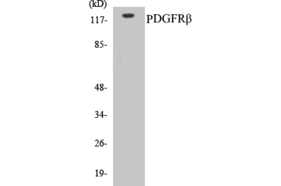 Western Blot - PDGFR beta Cell Based ELISA Kit (CB5545) - Antibodies.com