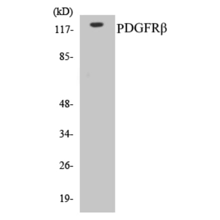 Western Blot - PDGFR beta Cell Based ELISA Kit (CB5545) - Antibodies.com
