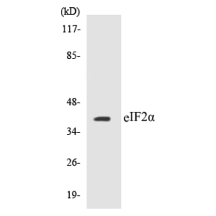 Western Blot - eIF2 alpha Cell Based ELISA Kit (CB5226) - Antibodies.com