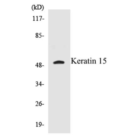 Western Blot - Keratin 15 Cell Based ELISA Kit (CB5394) - Antibodies.com