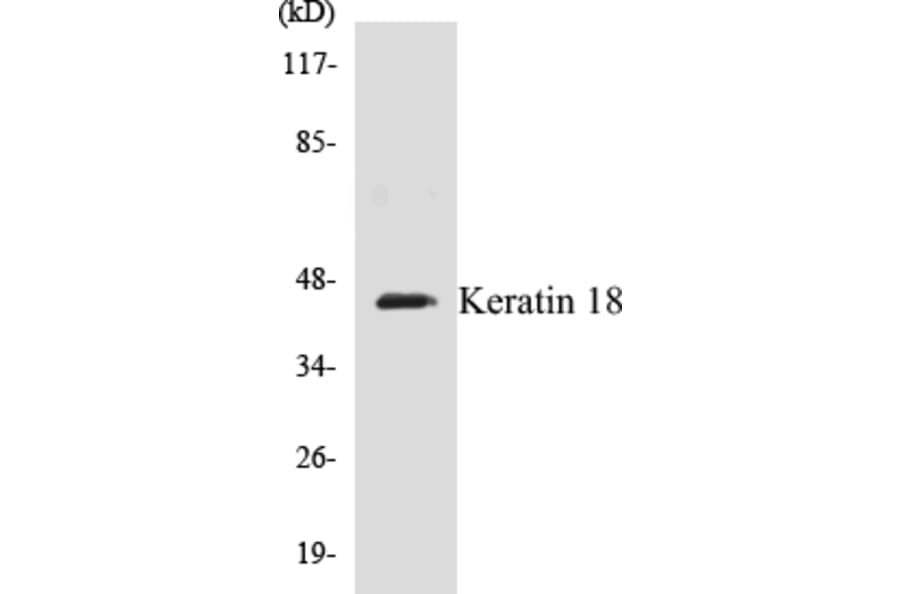 Western Blot - Keratin 18 Cell Based ELISA Kit (CB5397) - Antibodies.com