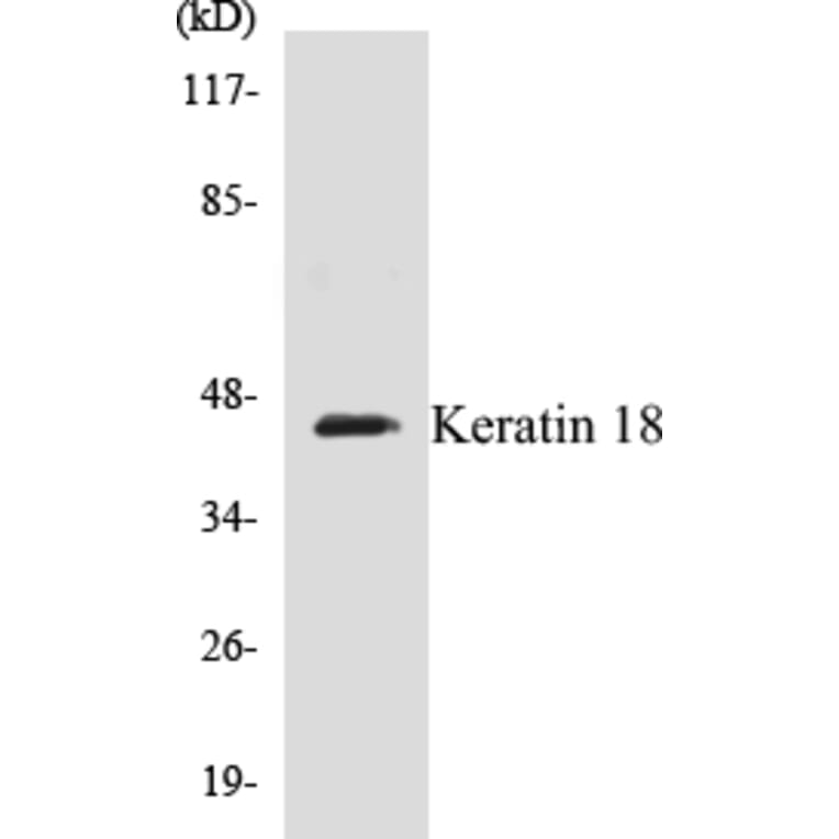 Western Blot - Keratin 18 Cell Based ELISA Kit (CB5397) - Antibodies.com