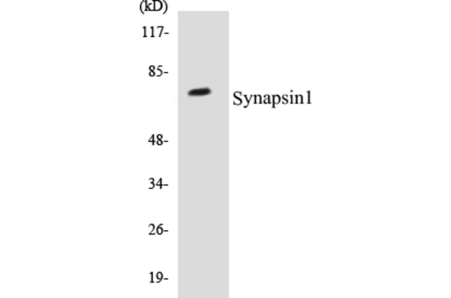 Western Blot - Synapsin 1 Cell Based ELISA Kit (CB5668) - Antibodies.com
