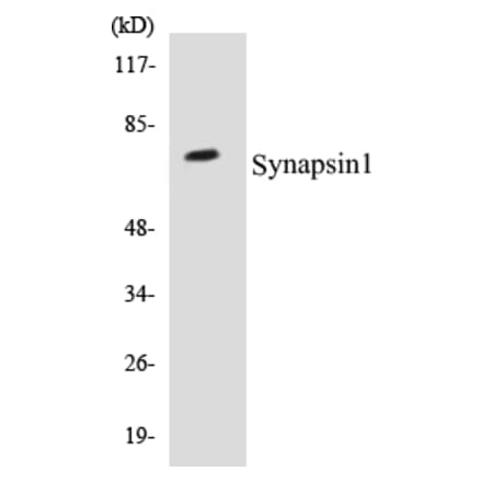 Western Blot - Synapsin 1 Cell Based ELISA Kit (CB5668) - Antibodies.com