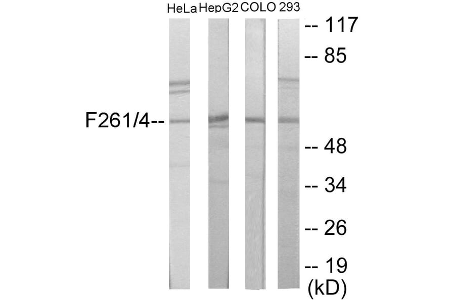 Western Blot - PFKFB1 + 4 Cell Based ELISA Kit (CB6043) - Antibodies.com