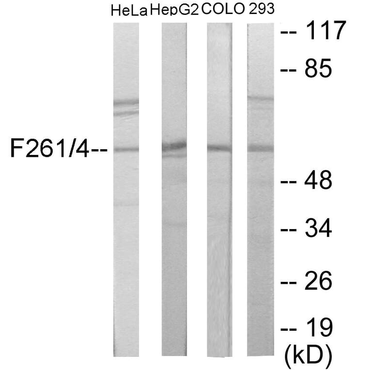 Western Blot - PFKFB1 + 4 Cell Based ELISA Kit (CB6043) - Antibodies.com