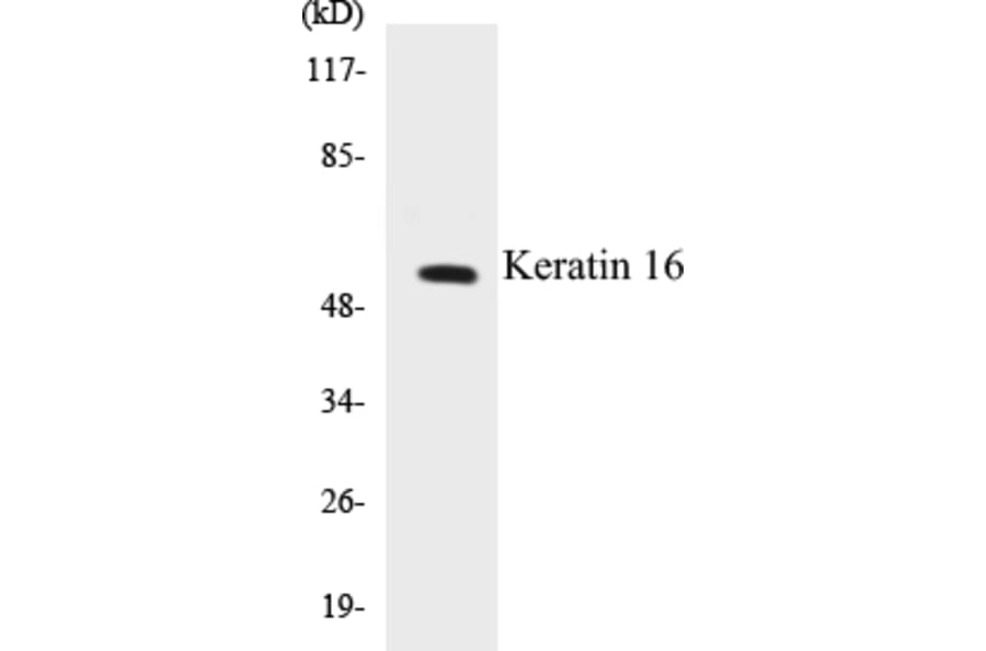 Western Blot - Keratin 16 Cell Based ELISA Kit (CB5395) - Antibodies.com