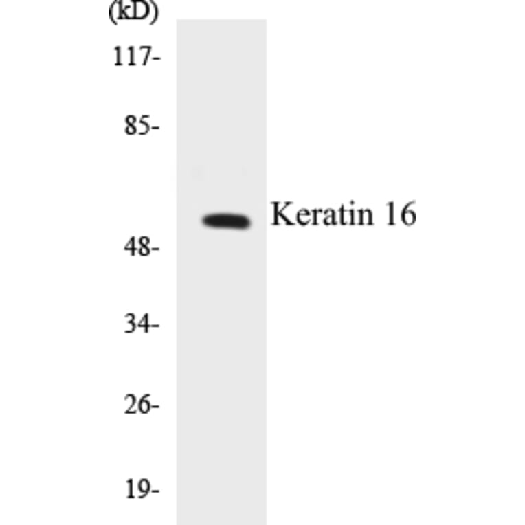 Western Blot - Keratin 16 Cell Based ELISA Kit (CB5395) - Antibodies.com