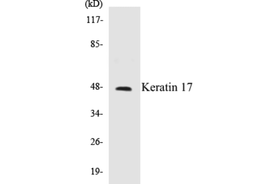 Western Blot - Keratin 17 Cell Based ELISA Kit (CB5396) - Antibodies.com