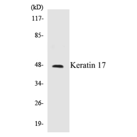 Western Blot - Keratin 17 Cell Based ELISA Kit (CB5396) - Antibodies.com