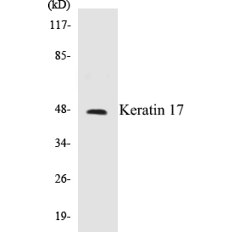 Western Blot - Keratin 17 Cell Based ELISA Kit (CB5396) - Antibodies.com