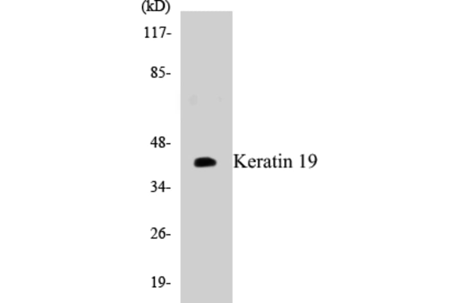Western Blot - Keratin 19 Cell Based ELISA Kit (CB5398) - Antibodies.com
