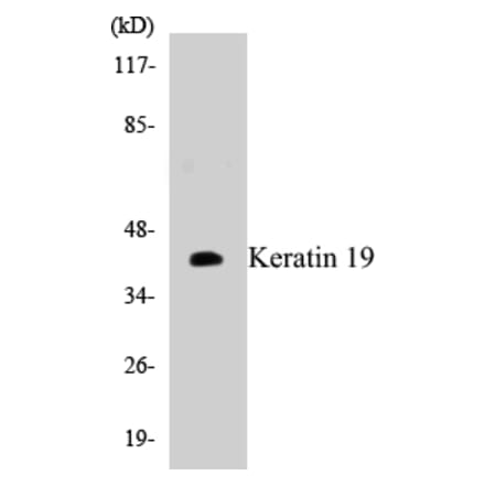 Western Blot - Keratin 19 Cell Based ELISA Kit (CB5398) - Antibodies.com