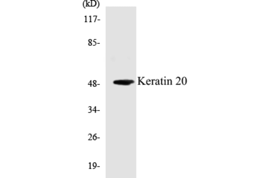 Western Blot - Keratin 20 Cell Based ELISA Kit (CB5399) - Antibodies.com