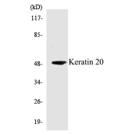 Western Blot - Keratin 20 Cell Based ELISA Kit (CB5399) - Antibodies.com