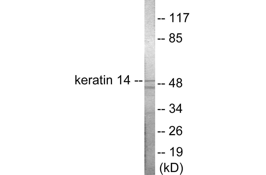 Western Blot - Keratin 14 Cell Based ELISA Kit (CB5749) - Antibodies.com