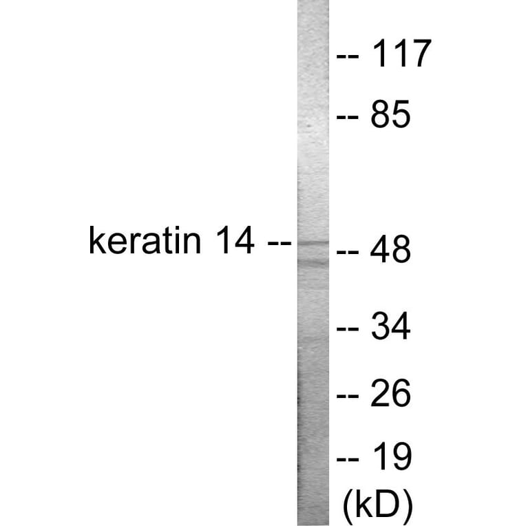 Western Blot - Keratin 14 Cell Based ELISA Kit (CB5749) - Antibodies.com