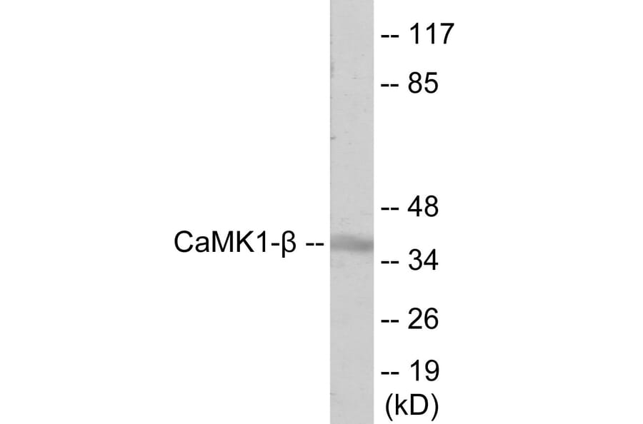 Western Blot - CaMK1 beta Cell Based ELISA Kit (CB6064) - Antibodies.com