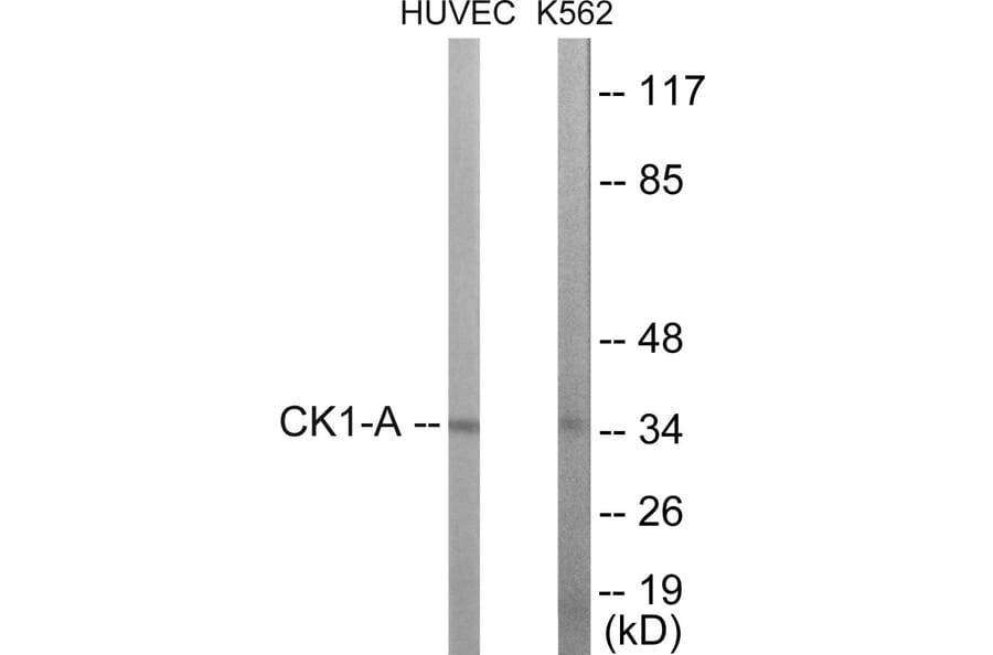 Western Blot - CKI alpha Cell Based ELISA Kit (CB5898) - Antibodies.com