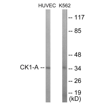 Western Blot - CKI alpha Cell Based ELISA Kit (CB5898) - Antibodies.com