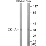 Western Blot - CKI alpha Cell Based ELISA Kit (CB5898) - Antibodies.com