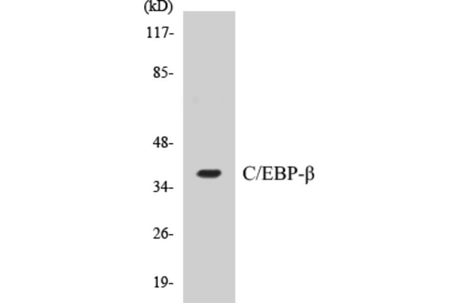 Western Blot - CEBP beta Cell Based ELISA Kit (CB5083) - Antibodies.com