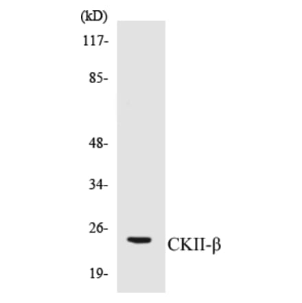 Western Blot - CKII beta Cell Based ELISA Kit (CB5139) - Antibodies.com