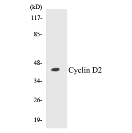Western Blot - Cyclin D2 Cell Based ELISA Kit (CB5187) - Antibodies.com