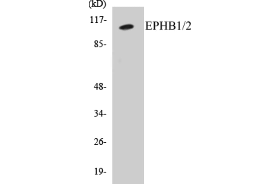 Western Blot - EPHB1 + 2 Cell Based ELISA Kit (CB5238) - Antibodies.com