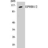 Western Blot - EPHB1 + 2 Cell Based ELISA Kit (CB5238) - Antibodies.com