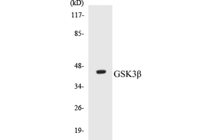 Western Blot - GSK3 beta Cell Based ELISA Kit (CB5312) - Antibodies.com