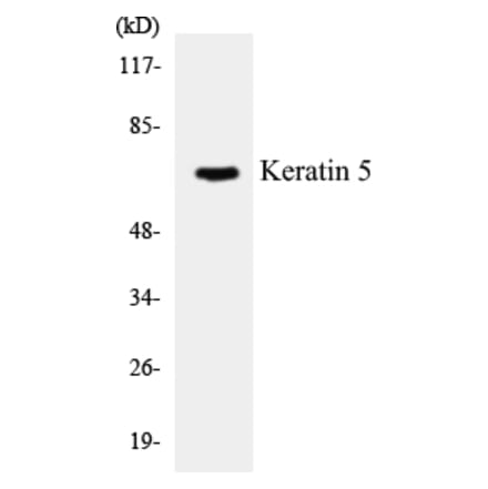 Western Blot - Keratin 5 Cell Based ELISA Kit (CB5400) - Antibodies.com
