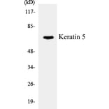 Western Blot - Keratin 5 Cell Based ELISA Kit (CB5400) - Antibodies.com